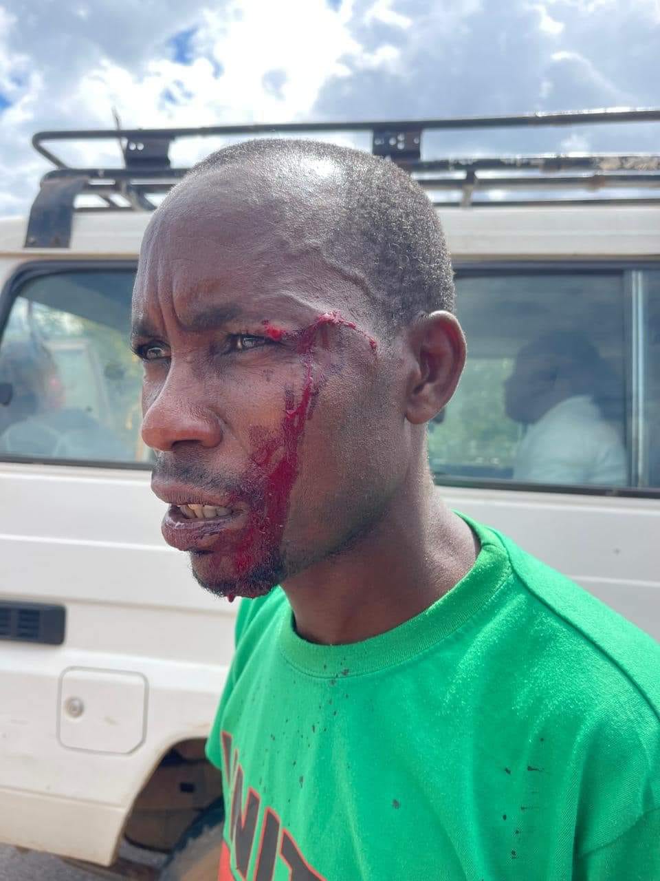 Membro da UNITA Ferido no incindente no kuando kubango 12-04-2024 foto (1).jpg